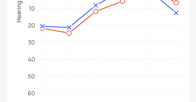 Do Online Hearing Tests Actually Work?  image