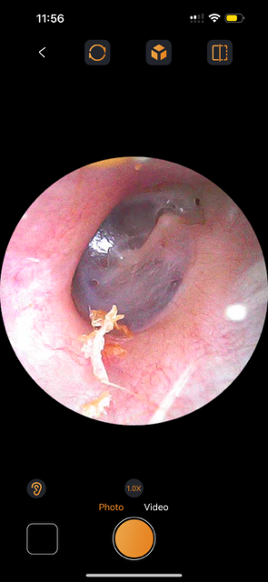 Hearing Loss Kingwood